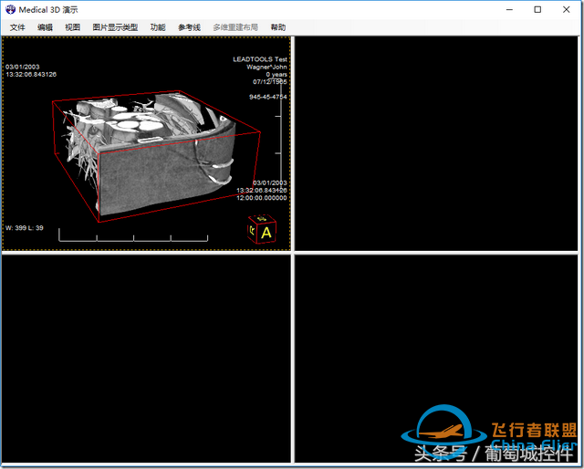 LEADTOOLS醫學三維影像演示使用入門-9826