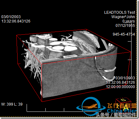 LEADTOOLS醫學三維影像演示使用入門-2609