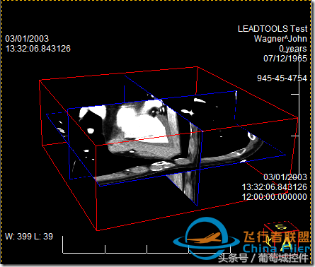 LEADTOOLS醫學三維影像演示使用入門-2710