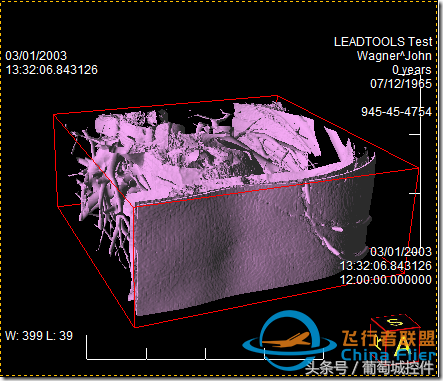 LEADTOOLS醫學三維影像演示使用入門-419