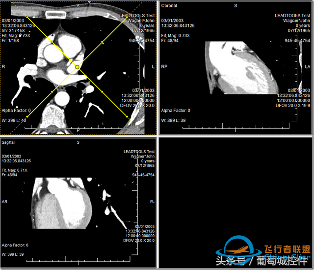 LEADTOOLS醫學三維影像演示使用入門-8655